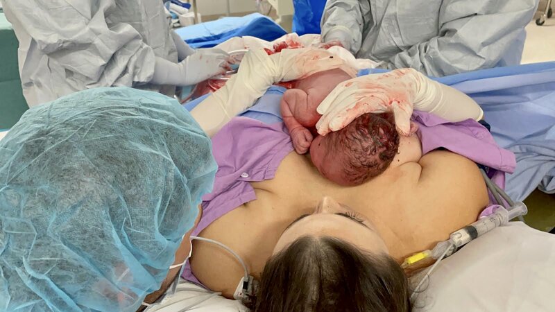 Mum in surgery holding newborn baby to her chest skin to skin