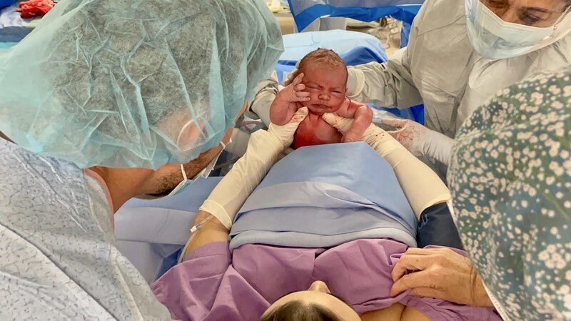 Mum in surgery reaching and pulling her baby out via maternal assisted delivery