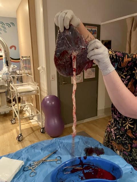Placenta and umbilical cord
